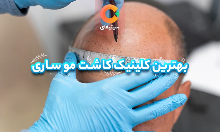 بهترین کلینیک کاشت مو ساری